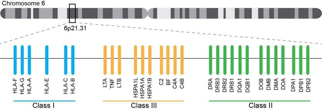 Effect of HLA Typing on Human Intestinal Cancer Research
