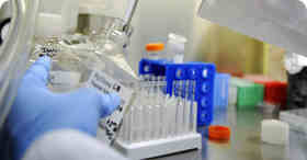 The Advantages and Workflow of ChIP-seq